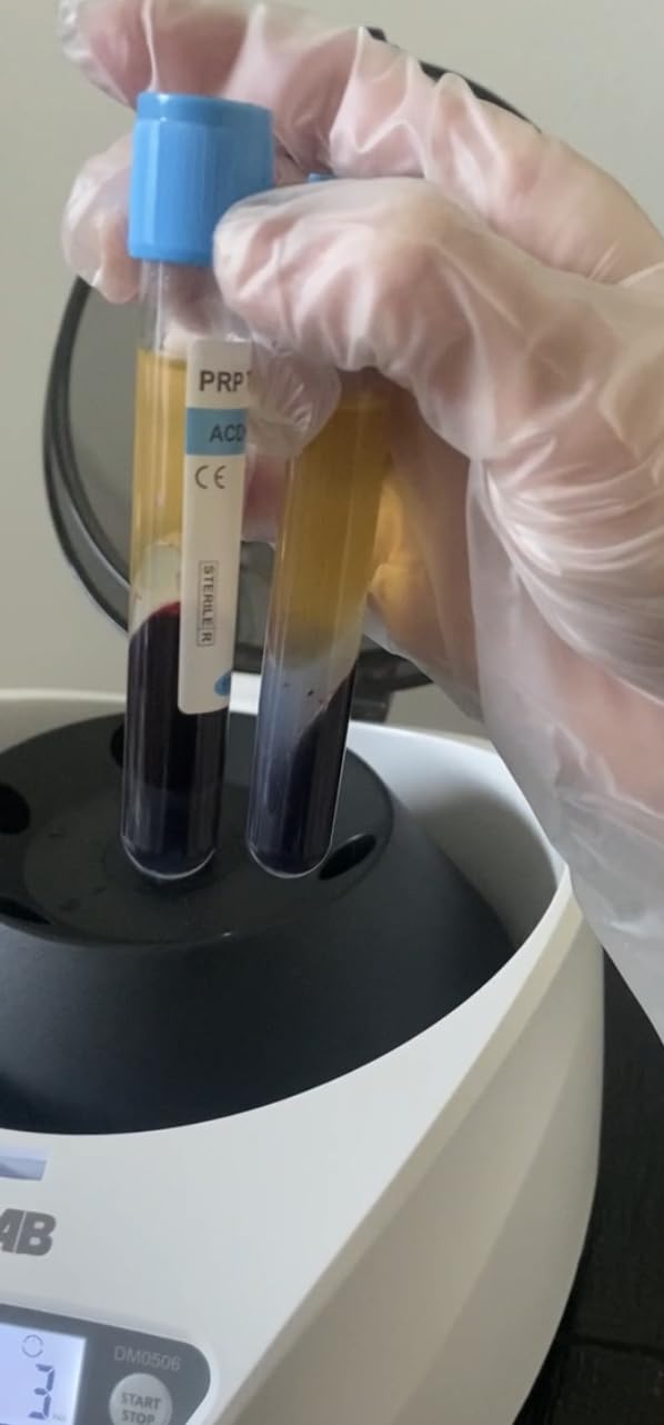 ONiLAB PRP Centrifuge, 8X15ml/10ml/7ml/1.5-5ml, 300-4000RPM, Max 1860xg | Digital Centrifuge with 30sec-99min55sec Timer, Continuous Mode, Low Noise 55dB and 110V Power Supply customer photo 2