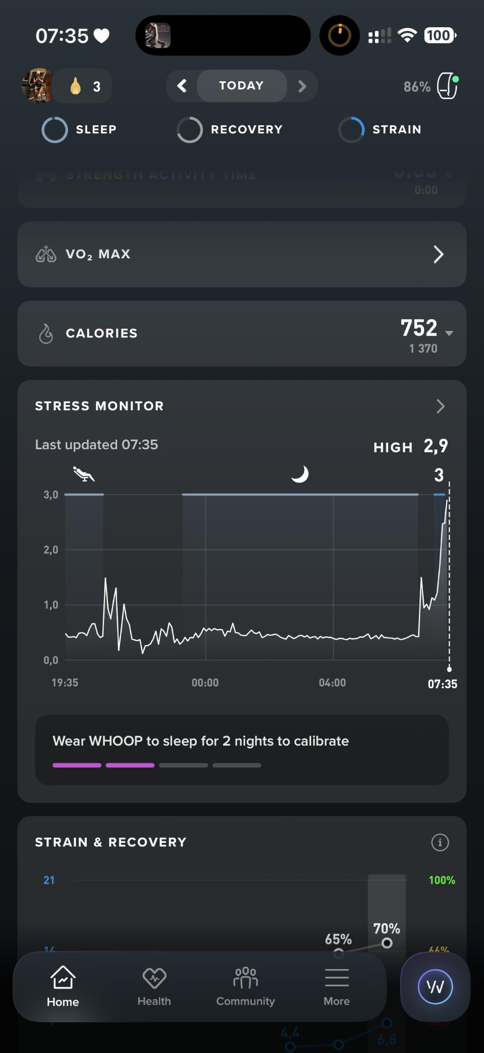 WHOOP 5.0/MG Activity Tracker - 12 Month Membership - Health and Fitness Wearable – 24/7 Activity and Sleep Tracker, Personalized Coaching, Menstrual Cycle Insights – 14+ Days Battery Life customer photo 1