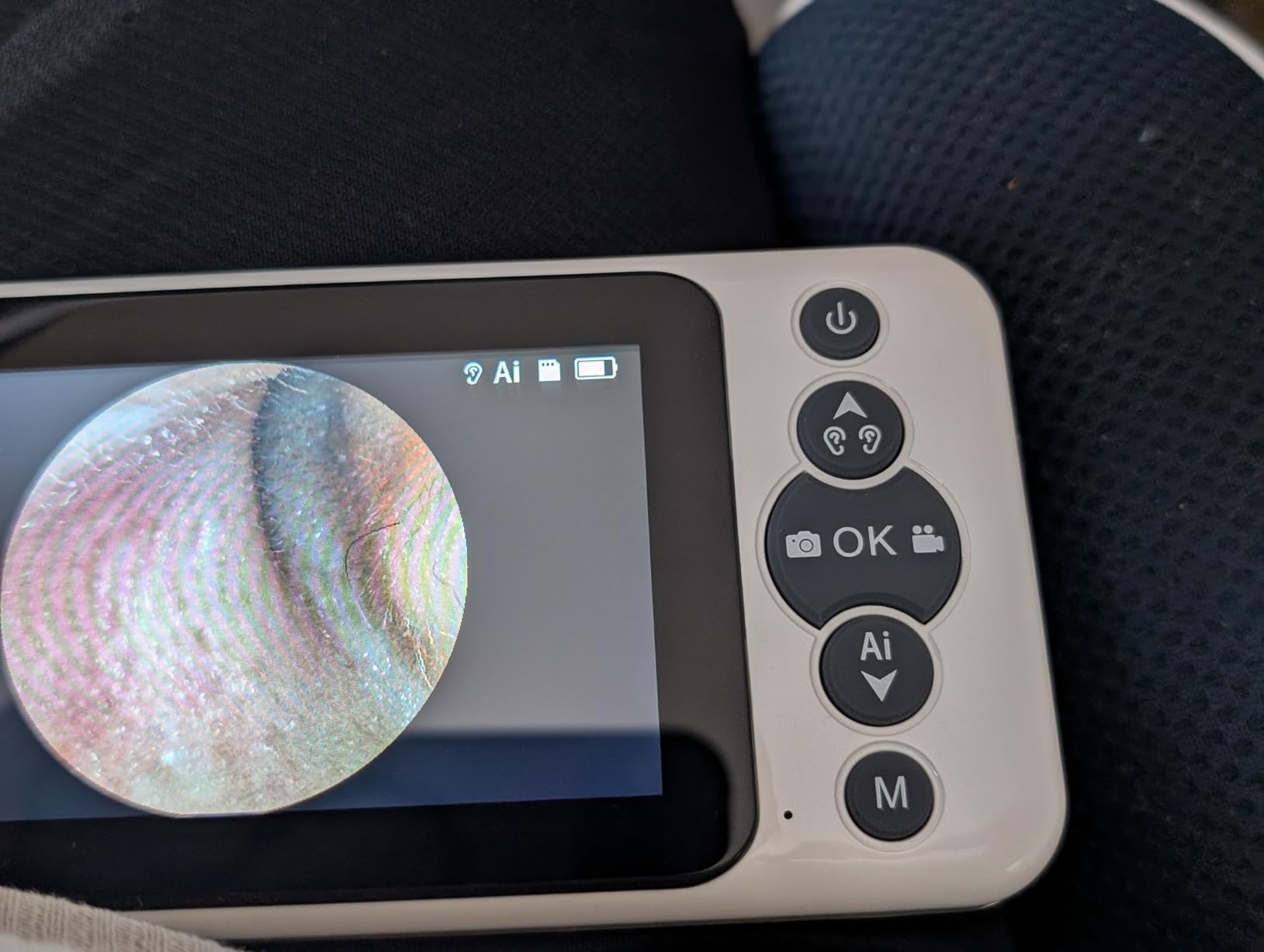 Digital Otoscope with 4.5