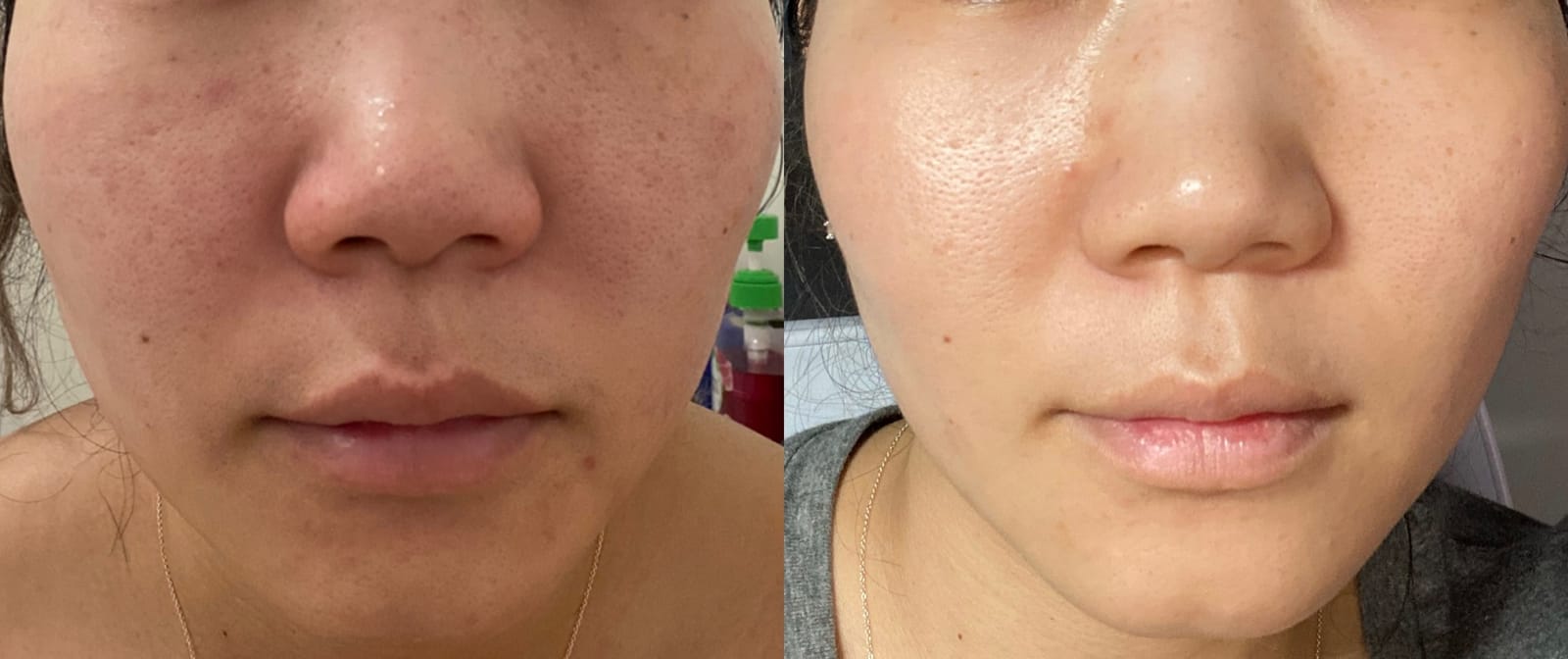 Paula's Choice SKIN PERFECTING 2% BHA Liquid Leave-On Exfoliant customer photo 1