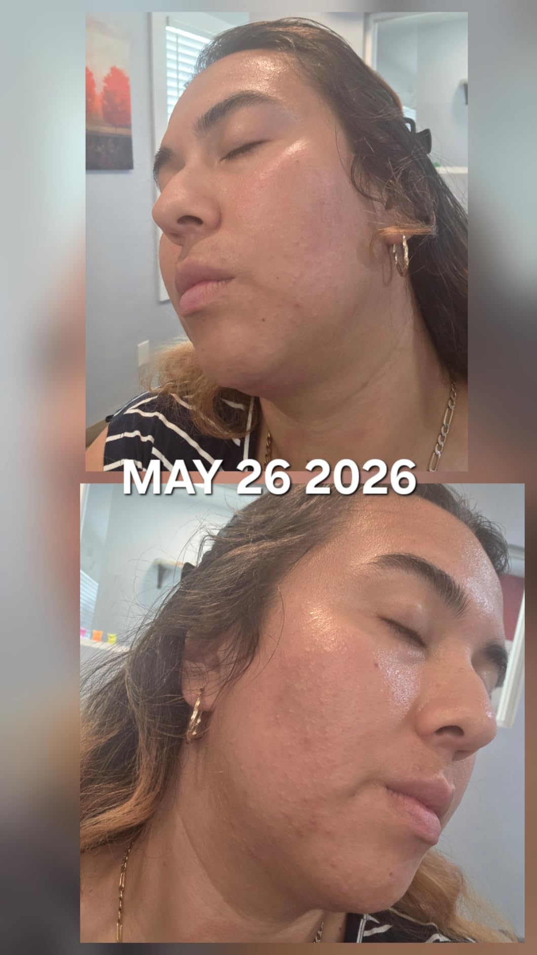 Paula's Choice SKIN PERFECTING 2% BHA Liquid Leave-On Exfoliant customer photo 2