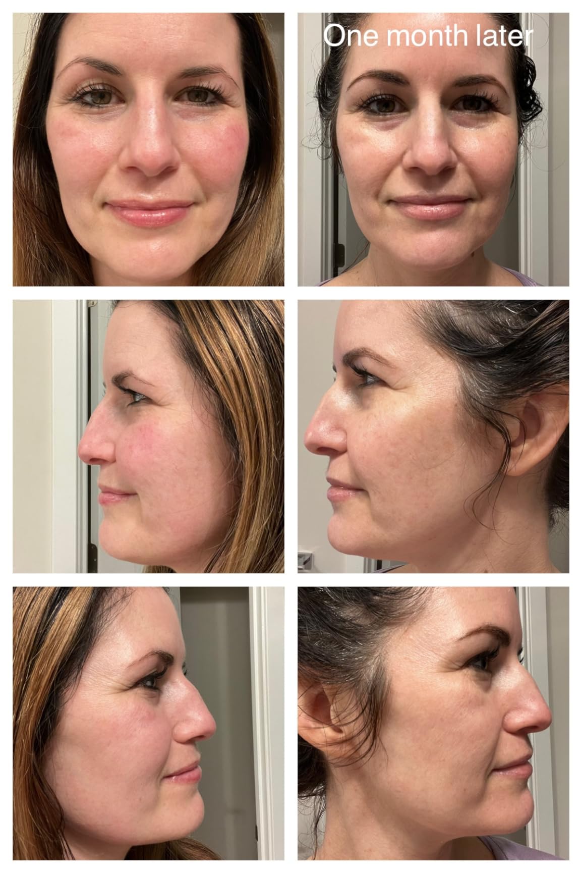 CeraVe Skin Brightening Vitamin C Serum for Face with Hyaluronic Acid, 1oz customer photo 2