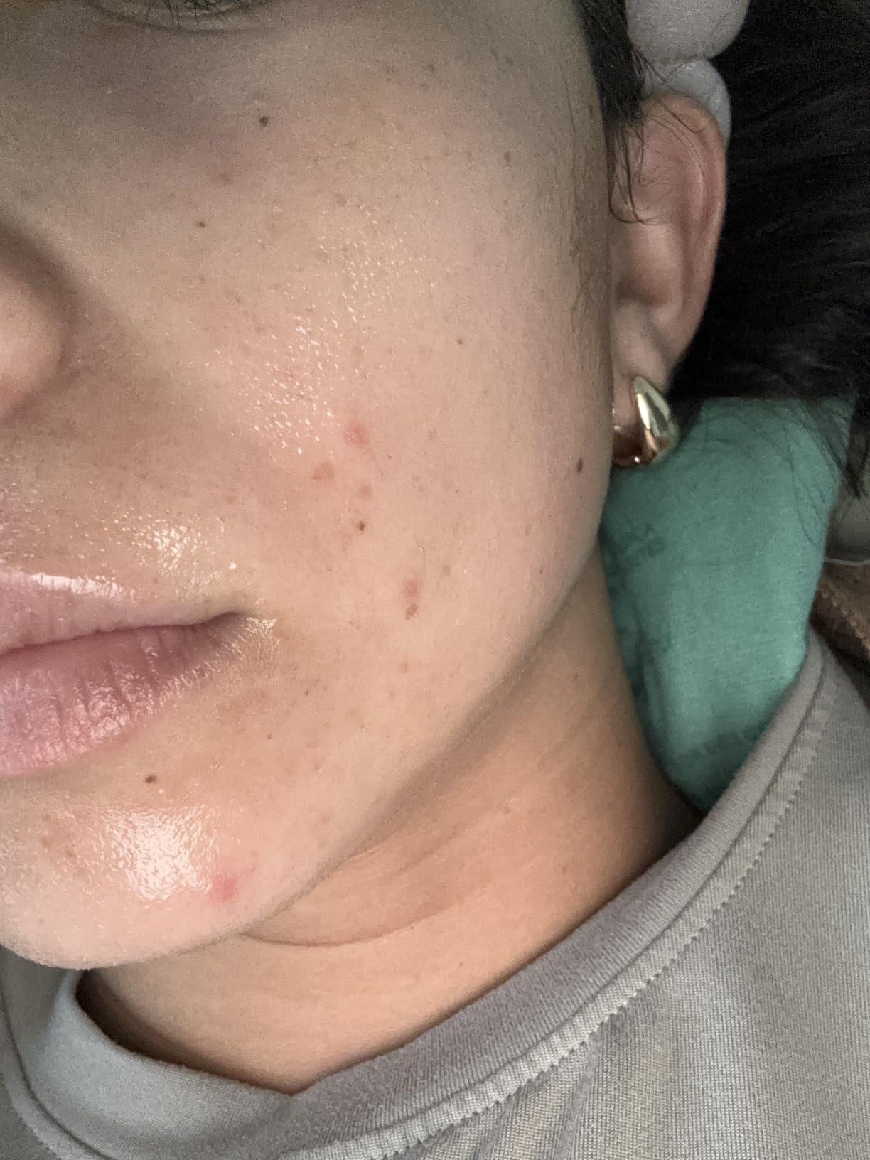 medicube Wrapping Mask Collagen - Overnight Peel Off Facial Mask customer photo 2