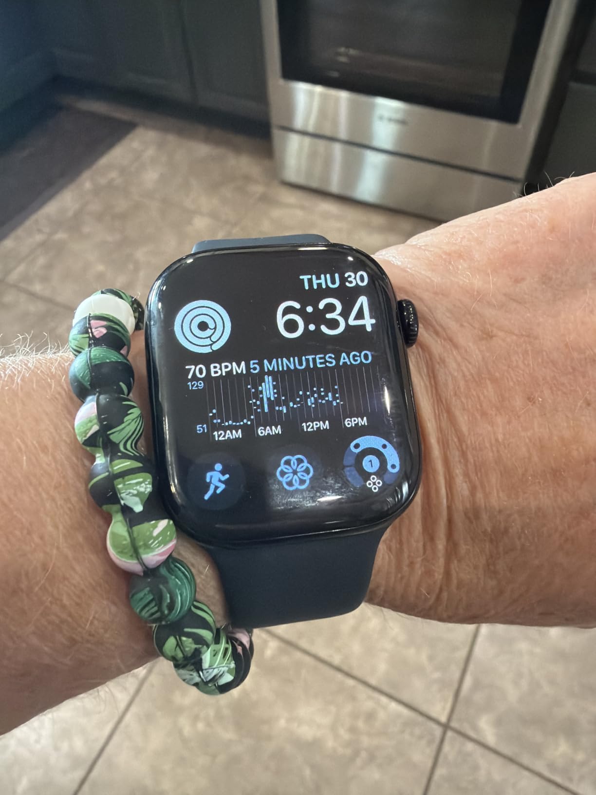 Apple Watch Series 11 customer photo 1
